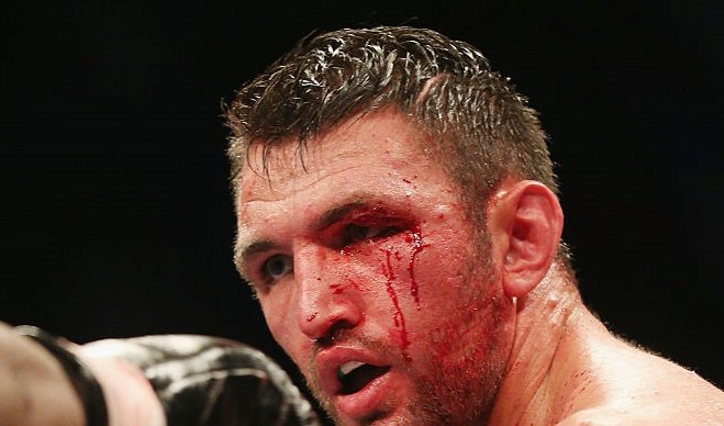 hughie-fury-cut-kassi-2