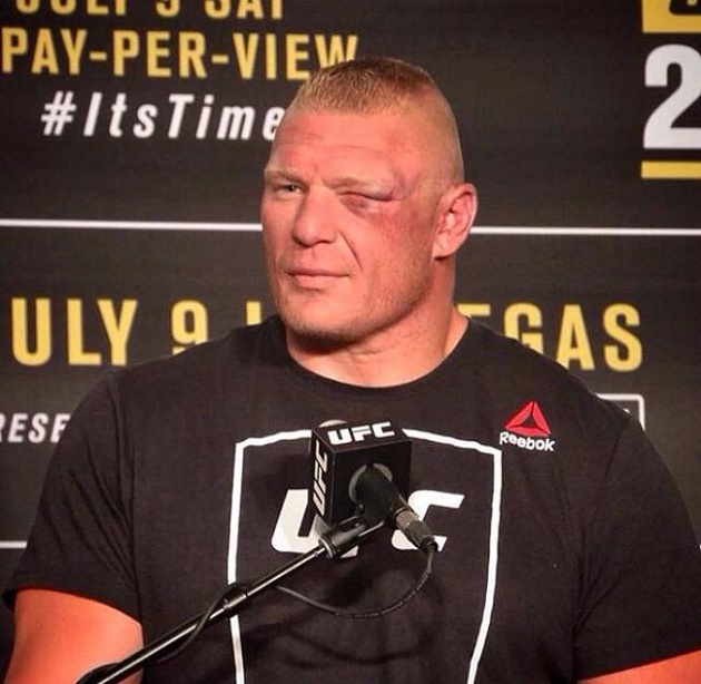 lesnar